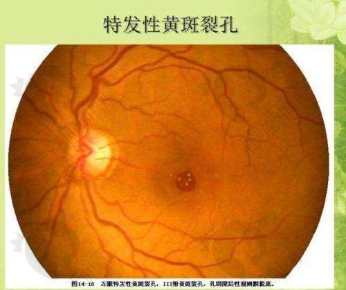 北京民众眼科医院齐越医生简介