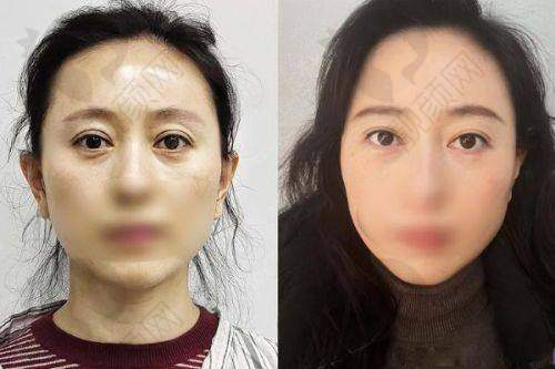 上海安禾美阁郑小红医生的真实的患者评价如下：