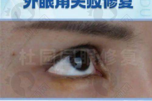 一、成都东篱整形医院怎么样？