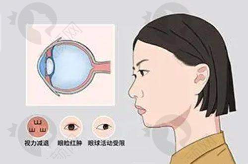 一、青岛华厦眼科医院怎么样？