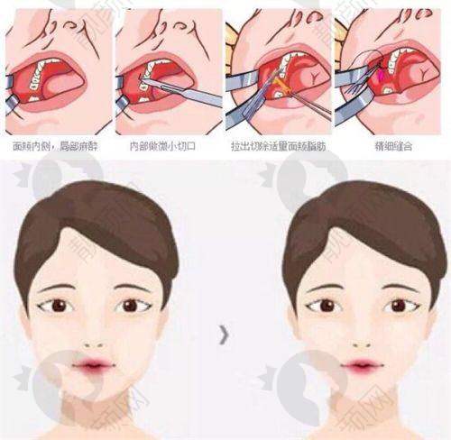 三、成都东篱整形医院医生介绍: