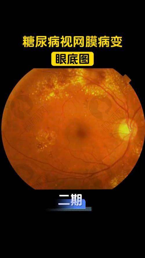 北京同仁眼科王红医生的真实的患者评价如下：