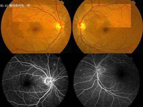 北京同仁眼科王红医生个人资质