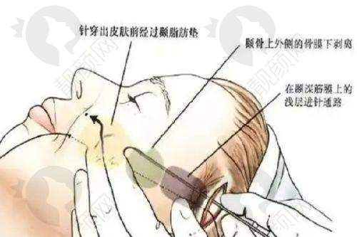 如何选择适合自己的医美机构