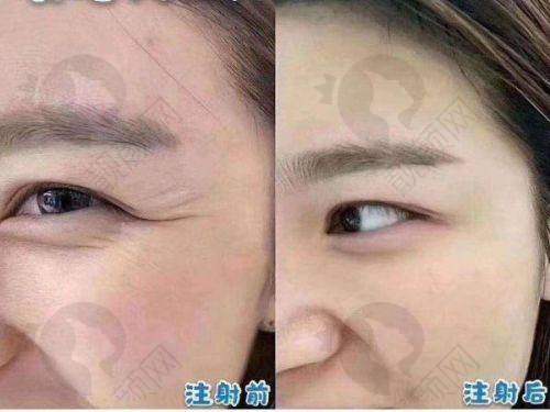 与其他济南医美医院对比