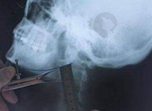 当地部分正规整形医院盘点