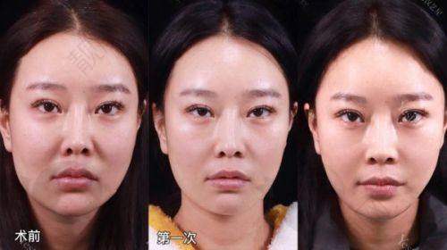 一、太原军大医疗美容医院怎么样？