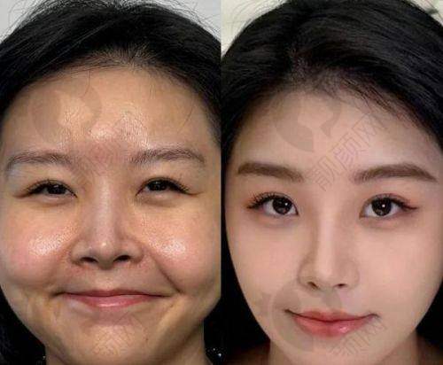 上海丽质医疗美容:个性设计,优雅之美