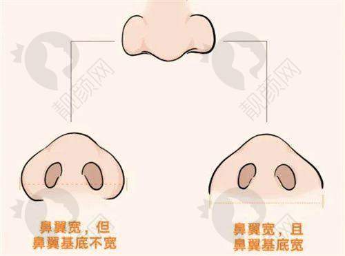 线提升价格