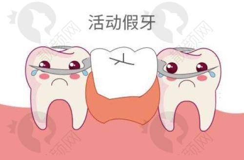 2025北碚种植牙多少钱一颗?重庆北碚贝乐嘉口腔口碑为何好