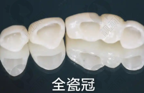 乌鲁木齐美奥口腔是坑人的吗?不存在!正规连锁口碑好,光明路店技术优值得信赖