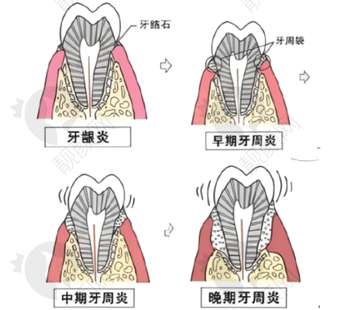 五、四川成都华 西医院口腔科怎么预约：