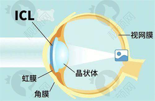 广西医科大学第一附属医院眼科全飞秒价格背后的医生实力