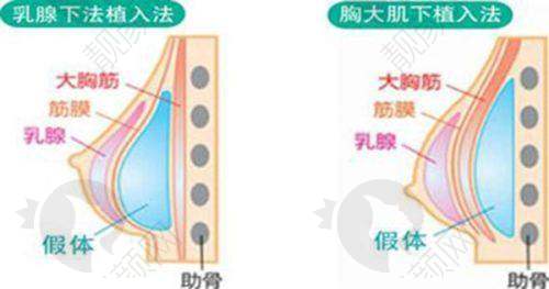 五、上海华美整形医院怎么预约：