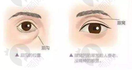 顾客如何选择适合自己的医美项目
