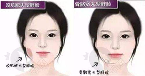 七、上海华美整形医院真实的患者评价如下：