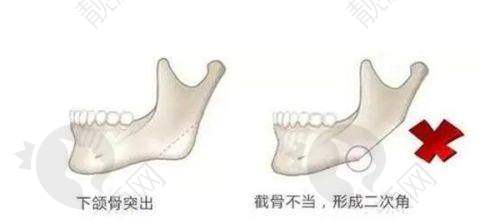广州可玉杨宇医生专精实力介绍