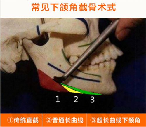 核心优势