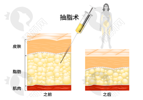 术后管理与服务