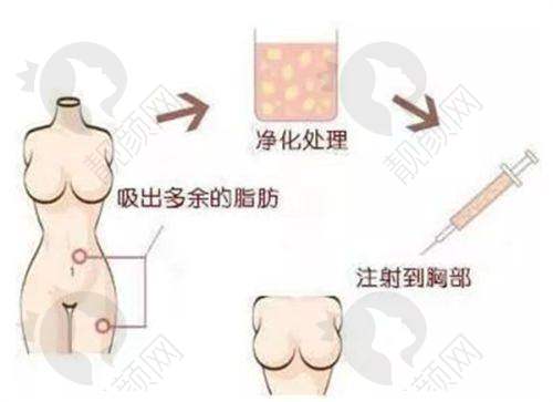 六、上海华美整形医院价格表：（仅供参考）