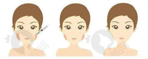 热门项目 - 眼部综合