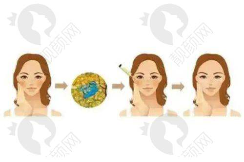 医美行业的发展趋势