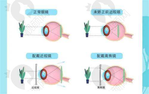广西医科大学第一附属医院眼科全飞秒价格1.8万起，享微创、稳定矫正优势 