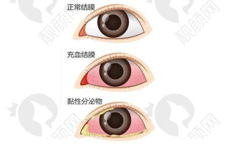 恩施慧宜眼科医院口碑评价