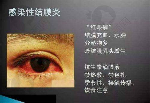 可预约北京华德眼科医院段安丽做后巩膜加固术——预约方式