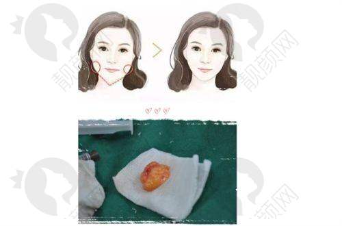 上海百达丽医疗美容:技术不错,服务贴心