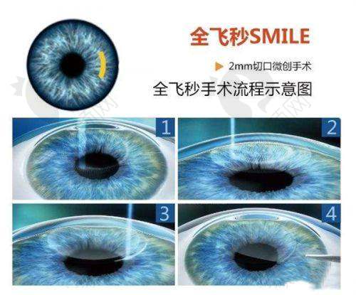 郑州爱尔眼科医院7600㎡院区技术强在哪?专精团队与精良设备齐上阵