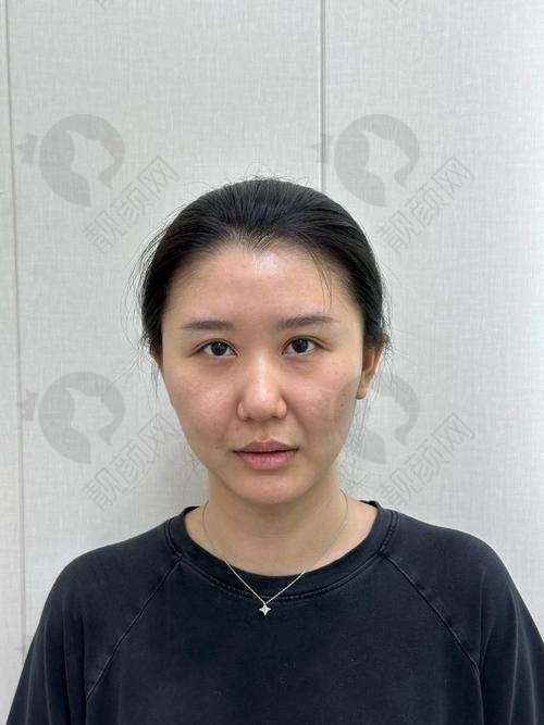 多项认证加持，法欧曼玻尿酸正规靠谱