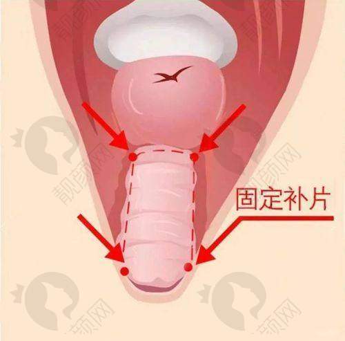 南京紧缩针在哪里预约？南京施尔美医院技术靠谱口碑好，可官网或电话预约