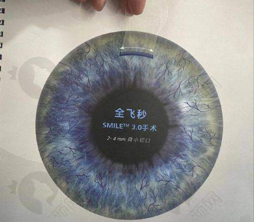 邯郸爱尔眼科医院个性化定制飞秒：口碑评价