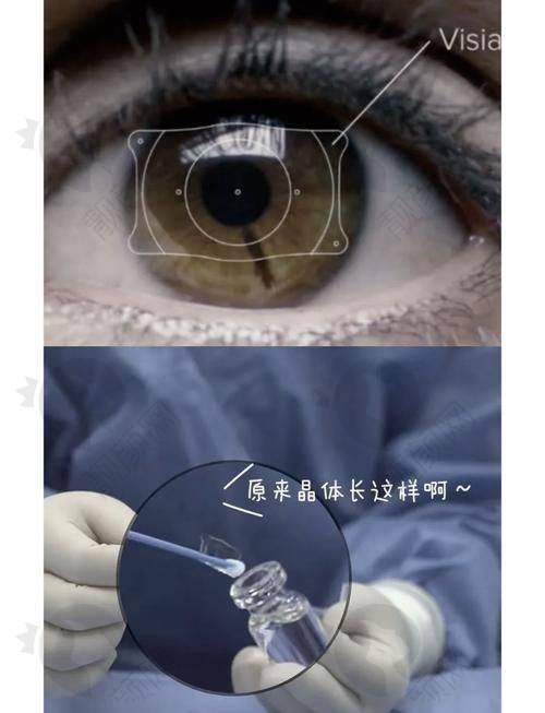口碑评价：患者满意度高