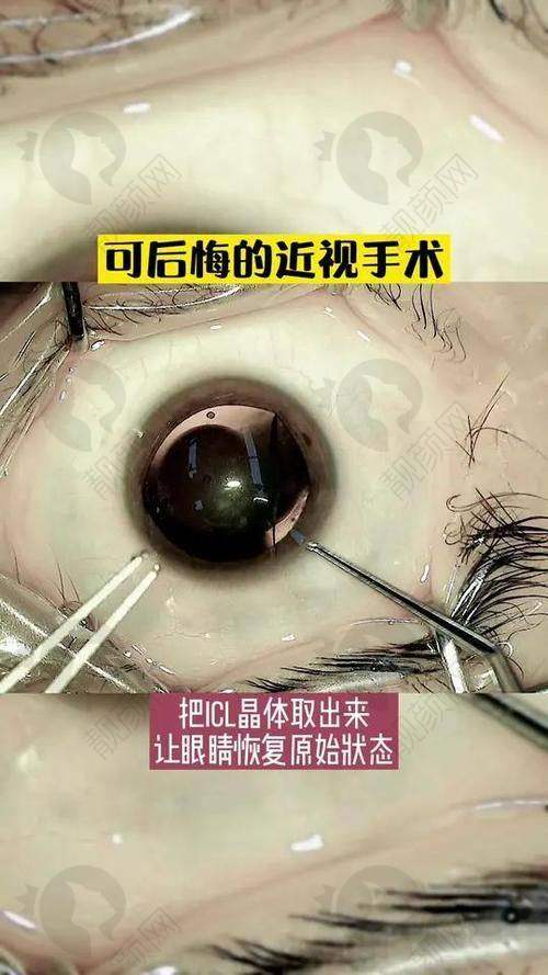 石家庄复明眼科医院：正规靠谱之选
