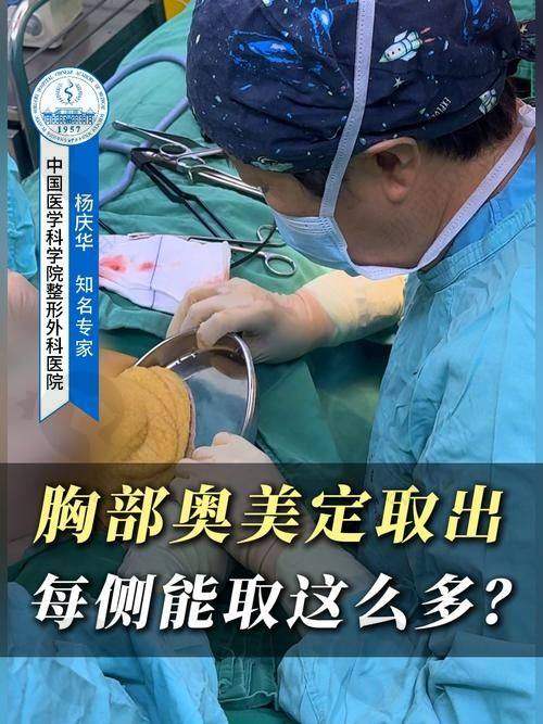 西安国际医学整形医院：骨干医生云集，胸部清奥成效好