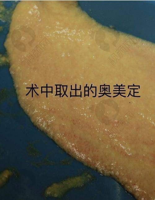 上海九院整复外科：具有影响力国有科室，清奥实力有保护
