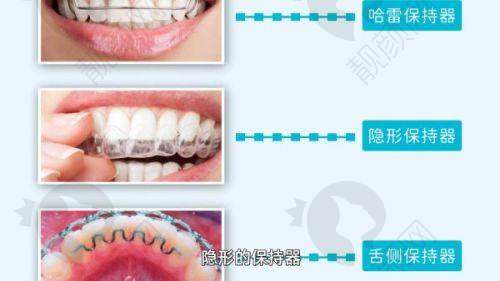 昆明医 科 大学附属口腔医院开展项目及价格