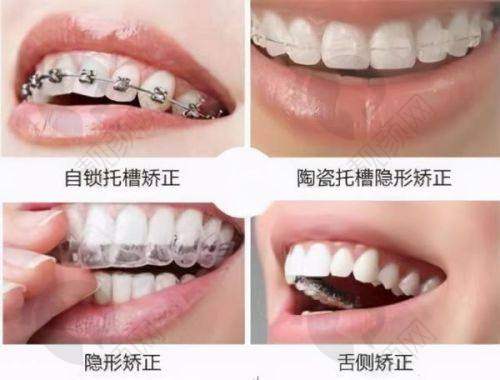南宁牙博士口腔贼全地址一览表——强大的医生团队