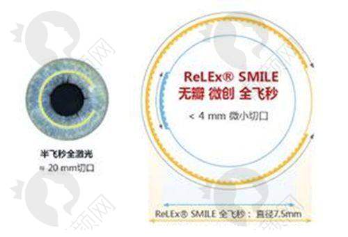 衡水眼科医院哪家好？爱尔、复明、同瑞排名前三，技术靠谱口碑佳地址电话快收藏