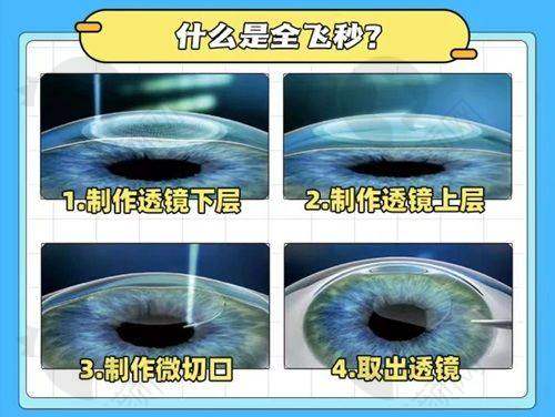 丹东郭氏眼科医院郭凌云医生的真实的患者评价如下：