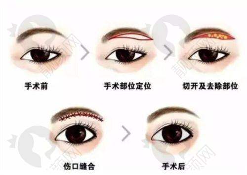 【华美整形美容医院价目表2025】玻尿酸价格详情