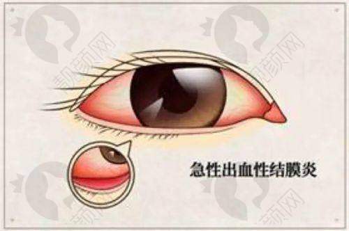二、重庆爱成眼科医院正规吗？来看看医院资质：