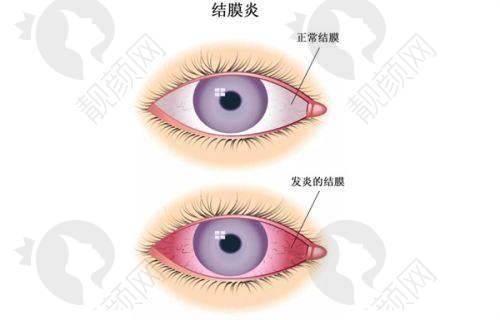 [北京大学深圳医院眼科收费价目表]——良好的口碑评价