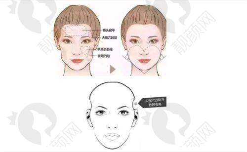 2025西安五大美容整形医院排名揭晓——西安画美医疗美容医院：精细手术与优质服务的代表