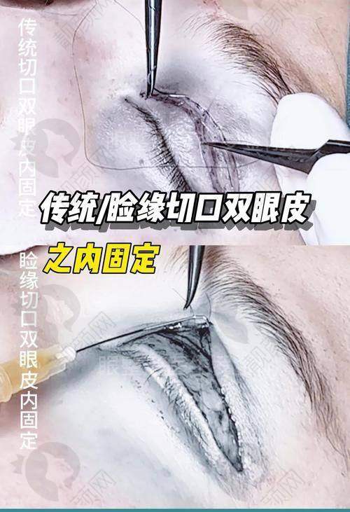 【揭秘】广州米伦整形：实力雄厚的医美机构