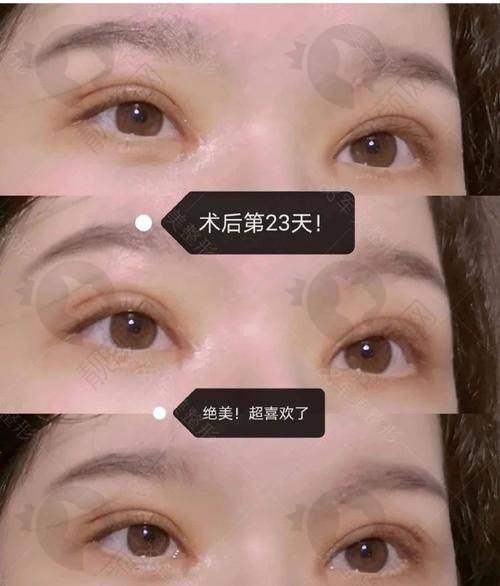 【揭秘】广州米伦整形：丰富多样的服务项目