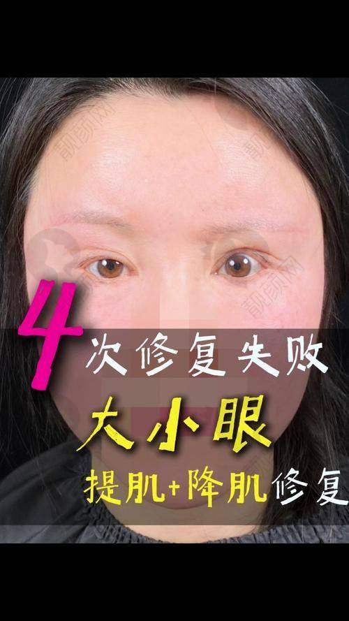 上海华美陈小剑医生简介