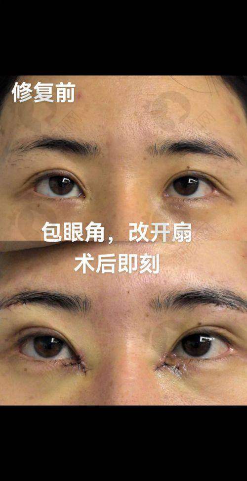 上海华美陈小剑医生的真实的患者评价如下：